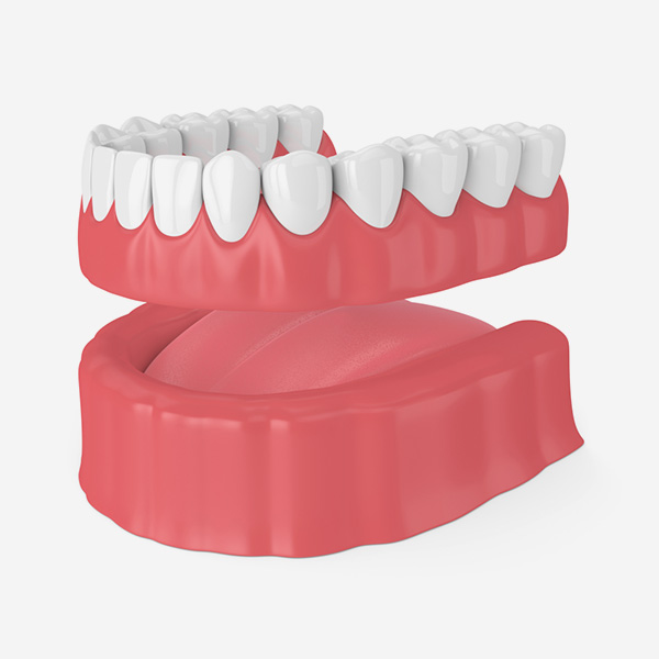 Denture